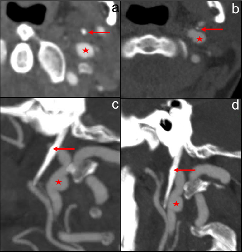 Fig. 3 –