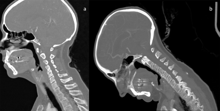 Fig. 2 –