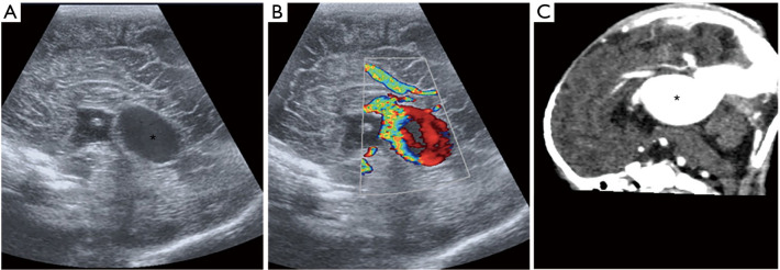 Figure 31