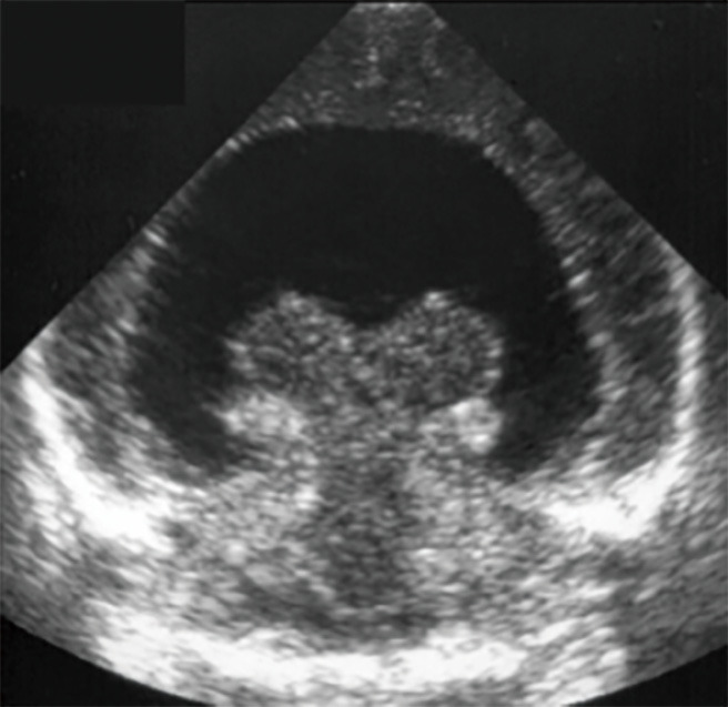 Figure 29