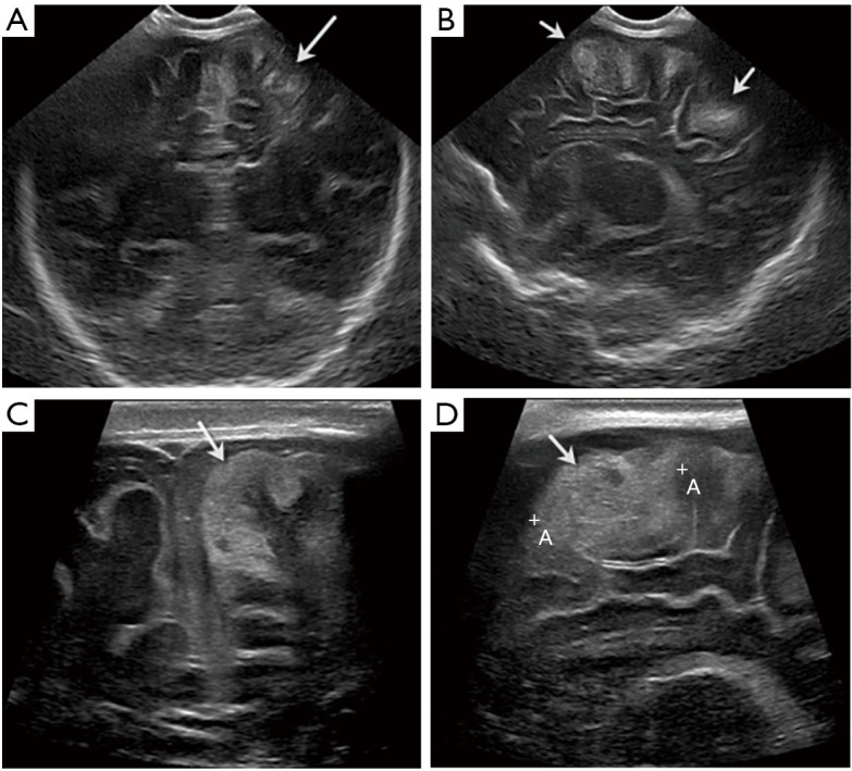 Figure 19