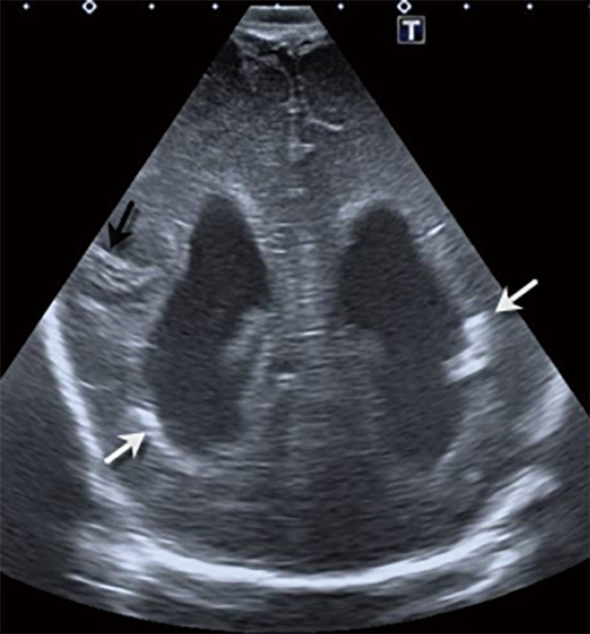 Figure 23