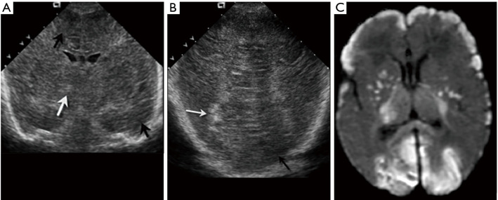 Figure 25