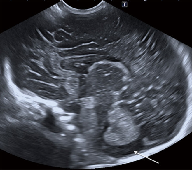 Figure 11