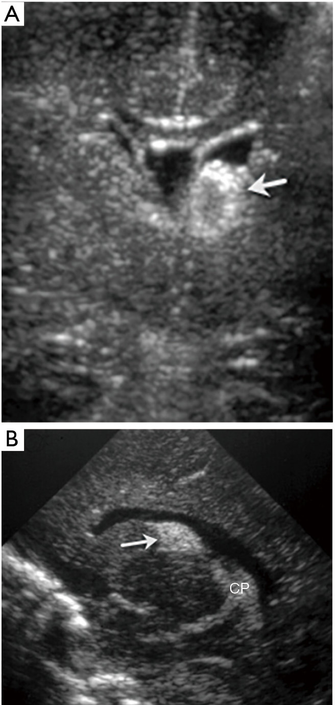 Figure 13