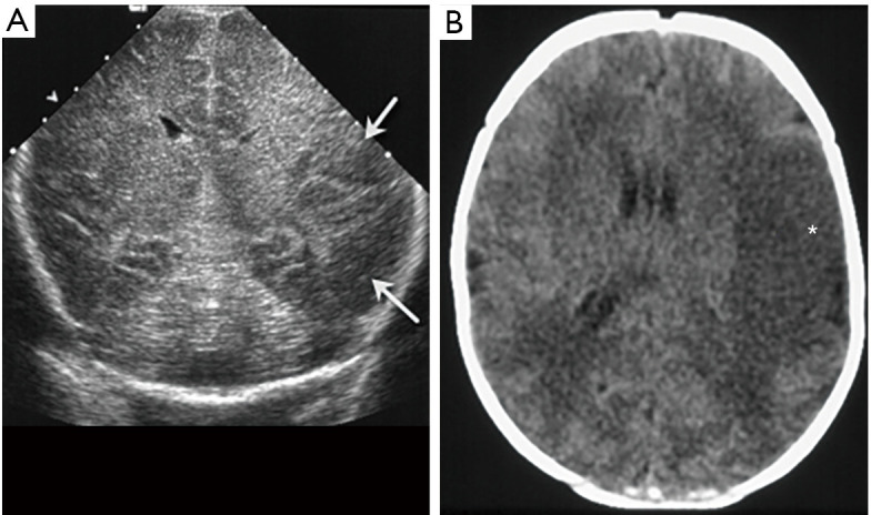 Figure 21