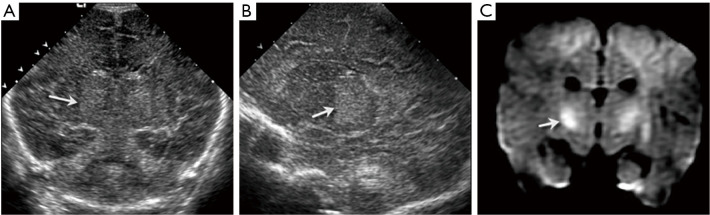 Figure 20