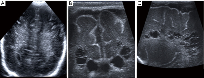 Figure 18