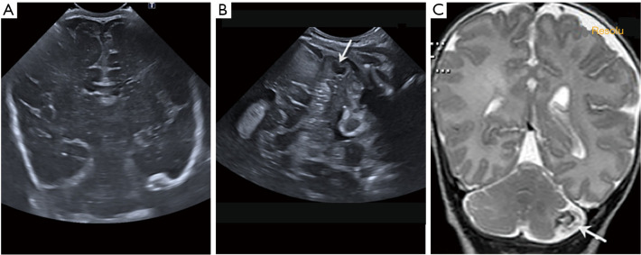 Figure 16