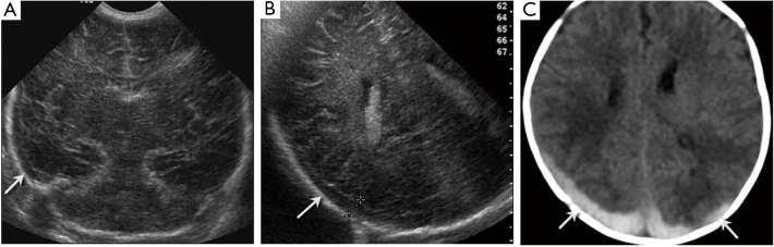 Figure 17