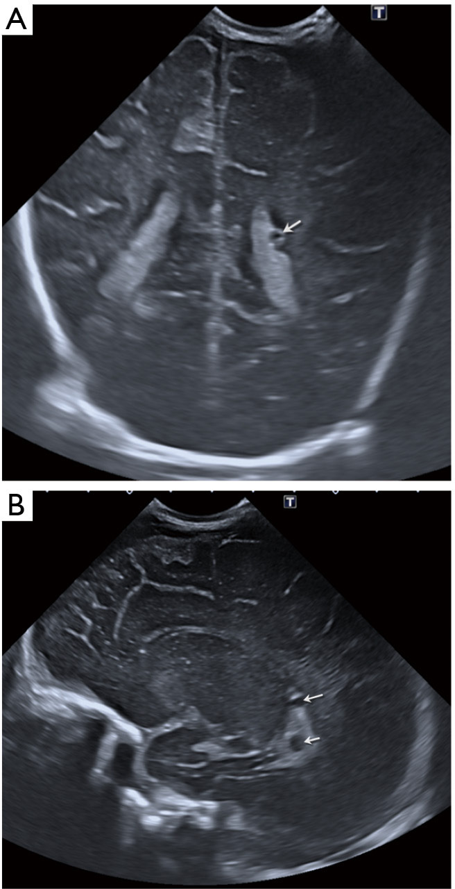 Figure 12