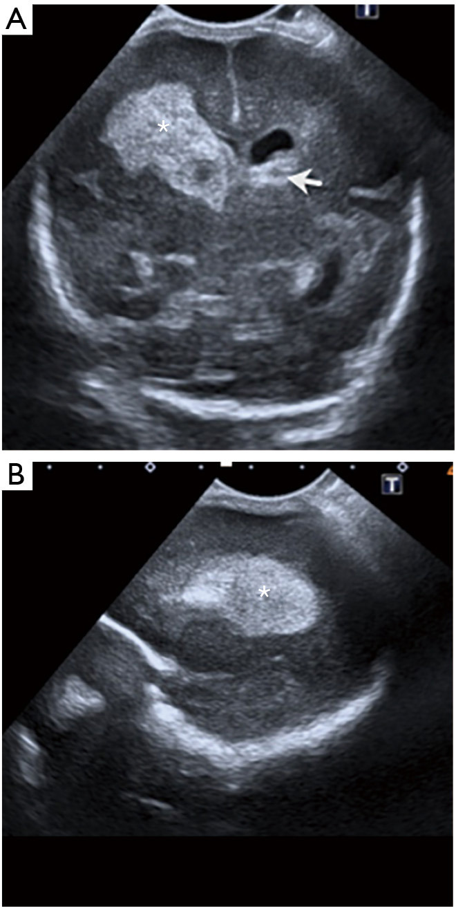 Figure 15