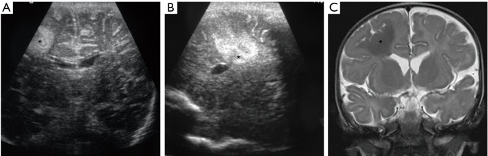Figure 30