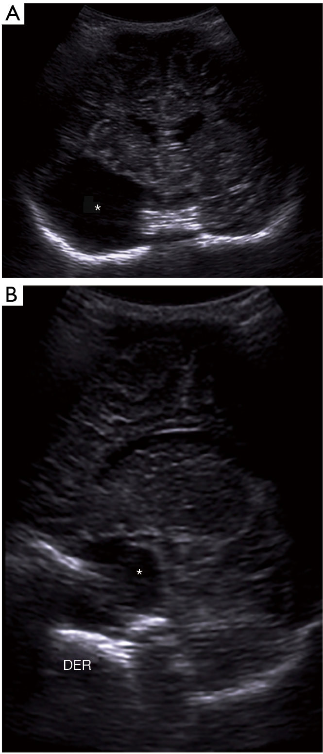 Figure 28