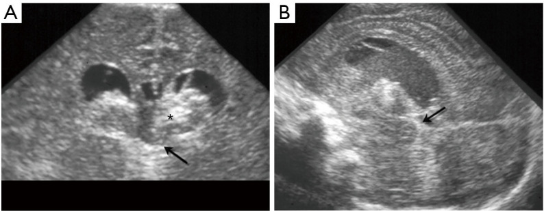 Figure 22