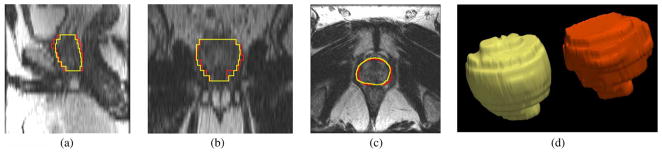 Fig. 19