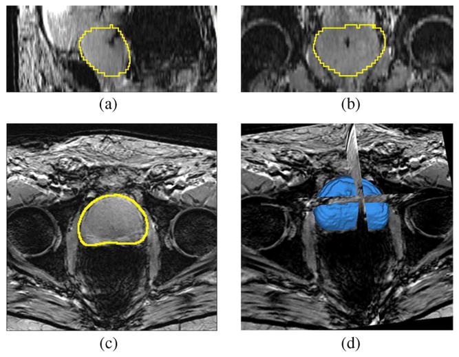 Fig. 12