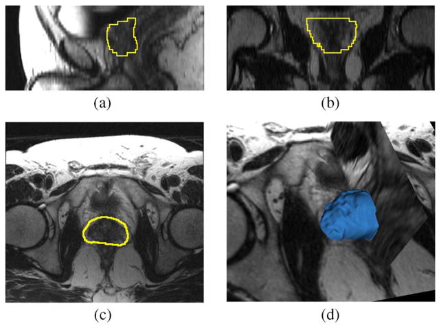 Fig. 15