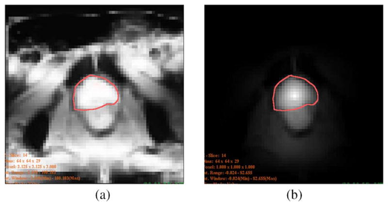 Fig. 10