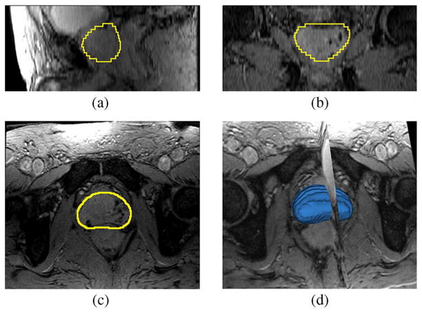 Fig. 13