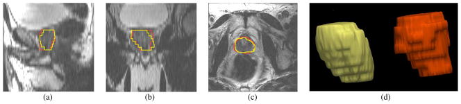 Fig. 16