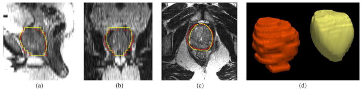 Fig. 18