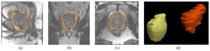 Fig. 17