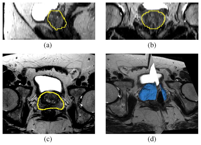 Fig. 14