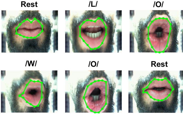 Fig. 14