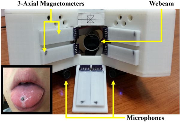 Fig. 1