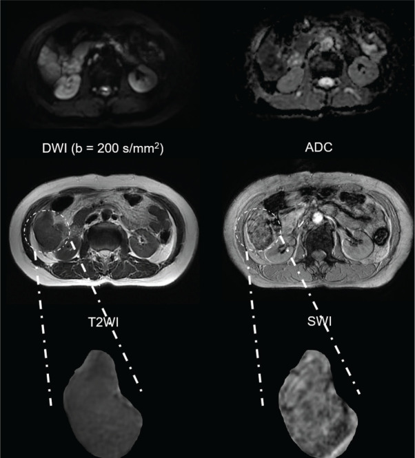 Fig. 2