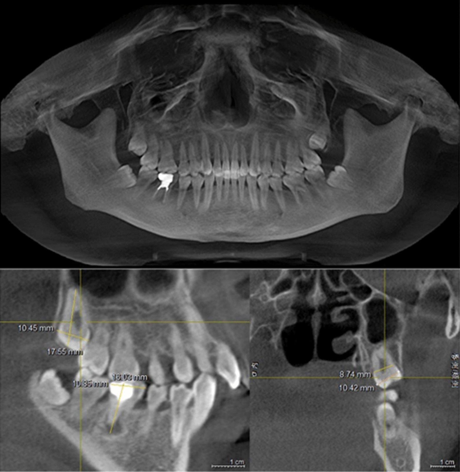 Fig. 1