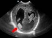FIG. 2.