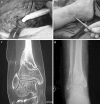 Fig. 5