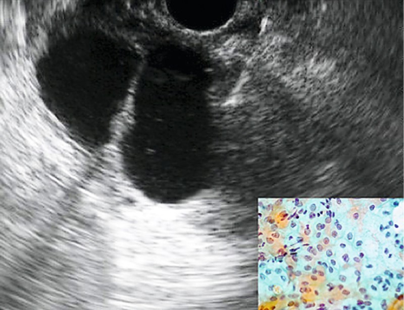 Fig. 1