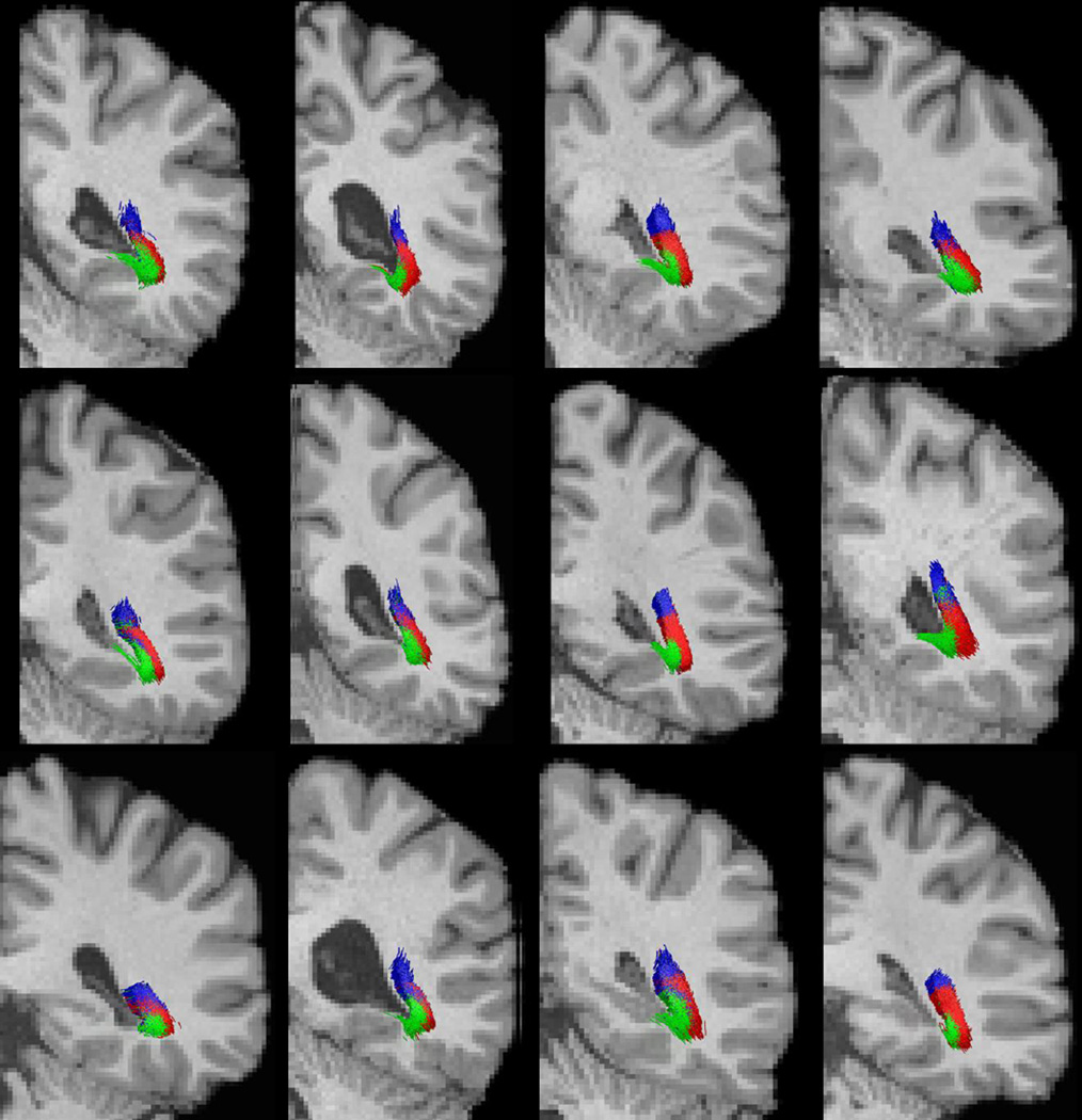 Figure 11