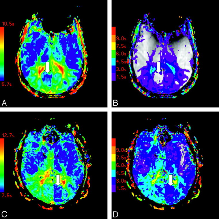 Fig 3.