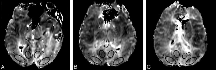 Fig 1.