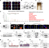 Figure 3. DHCR24 induces SUMO2 modification at K108 of hnRNPA2B1. A and B, Detection of the intracellular localization of DHCR24 in bladder cancer cells. Scale bars, 5 μm. C and D, Silver staining and mass spectrometry analysis for the detection of DHCR24-interacting proteins. E, Western blot analysis after co-IP assays with anti-DHCR24 or IgG in UM-UC-3 cells. F, Immunofluorescence assays for the colocalization of DHCR24 and hnRNPA2B1 in bladder cancer cells. Scale bars, 5 μm. G, PLA showing the interaction between hnRNPA2B1 and DHCR24 in UM-UC-3. Scale bars, 5 μm. H, Co-IP assays with DHCR24 to detect the PTM type of hnRNPA2B1 involved in the DHCR24 and hnRNPA2B1 interaction. I, Western blot analysis for the investigation of the SUMOylation type of hnRNPA2B1 in UM-UC-3 cells. J, Western blot analysis for the validation of SUMO2 modification on hnRNPA2B1. K, Western blot analysis to evaluate the effect of DHCR24 on SUMO2 modification on hnRNPA2B1 L. Western blot analysis to confirm the SUMO2 modification site on hnRNPA2B1. M, Western blotting analysis of SUMO2 modification on hnRNPA2B1 in indicated UM-UC-3 cells. N and O, qRT‒PCR of SUMOylation-related enzyme expression in the indicated UM-UC-3 cells. P, Detection of the interaction between DHCR24 and hnRNPA2B1 after hnRNPA2B1K108R mutations or using SENP3 in the indicated cells. Q, Western blot analysis to investigate the interaction between DHCR24 and hnRNPA2B1 after SIM mutation of DHCR24 in the indicated cells. Significant differences were assessed through the two-tailed Student t test in N and one-way ANOVA, followed by the Dunnett test in O. Error bars, SD. *, P < 0.05; **, P < 0.01.