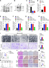 Figure 5. DHCR24 activates the TBK1/PI3K/Akt signaling pathway to promote VEGFC secretion by bladder cancer. A and B, Western blot analysis was performed to evaluate the expression of associated genes in the PI3K/Akt signaling pathway in DHCR24 knockdown or DHCR24-overexpressing UM-UC-3 cells. C and D. ELISA of VEGFC secretion in DHCR24 knockdown or DHCR24-overexpressing UM-UC-3 cells. E–H, qRT‒PCR analysis of VEGFC expression and ELISA analysis of VEGFC secretion in DHCR24-overexpressing UM-UC-3 or T24 cells with or without treatment with LY294002. I, Representative images and quantification of tube formation and migration of HLECs treated with CM from DHCR24-overexpressing UM-UC-3 cells with or without αVEGFC treatment. Scale bars, 100 μm. J, Quantification of bioluminescence of the popliteal metastatic LNs (n = 12) in mice of the indicated groups. K, The table shows the popliteal LN-metastatic rate in different groups (n = 12). L–N, Representative IHC images and quantification of DHCR24 and VEGFC expression and LYVE1-indicated lymphatic vessel density in footpad tumor tissues from the indicated mice. Scale bar, 50 μm. Significant differences were assessed through one-way ANOVA, followed by the Dunnett test in C, E–J, M, and N; two-tailed Student t test in D; and the χ2 test in K. Error bars , SD. *, P < 0.05; **, P < 0.01.