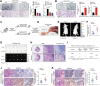 Figure 2. DHCR24 promotes lymphangiogenesis and LN metastasis of bladder cancer in vitro and in vivo. A and B, Representative images and quantification of tube formation and migration of HLECs treated with culture media from DHCR24 knockdown or -overexpressing UM-UC-3 cells. Scale bars, 100 μm. C and D, Schematic diagram of the construction of a nude mouse popliteal LN metastasis model. E and F, Representative images and quantification of bioluminescence of the popliteal metastatic LNs (n = 12). Red arrows, footpad tumor and metastatic popliteal LN. G, Representative images and bioluminescence of the popliteal LNs from mice (n = 12). H, Representative IHC images of anti-GFP analysis in the popliteal LNs from mice (n = 12). Red scale bars, 500 μm; black scale bars, 50 μm. I, The table shows the popliteal LN-metastatic rate in different groups (n = 12). J and K, Representative IHC images and quantification of DHCR24 expression and LYVE1–indicated lymphatic vessel density in the intratumoral (J) and peritumoral (K) regions of primary footpad tumor tissues. Scale bar, 50 μm. Significant differences were assessed through one-way ANOVA, followed by the Dunnett test in A; the χ2 test in I; and the two-tailed Student t test in B, F, J, and K. Error bars, SD. *, P < 0.05; **, P < 0.01. H&E, hematoxylin and eosin.