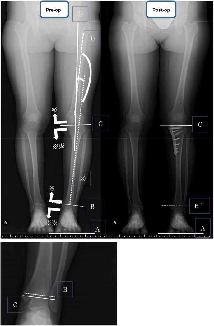 Fig. 1