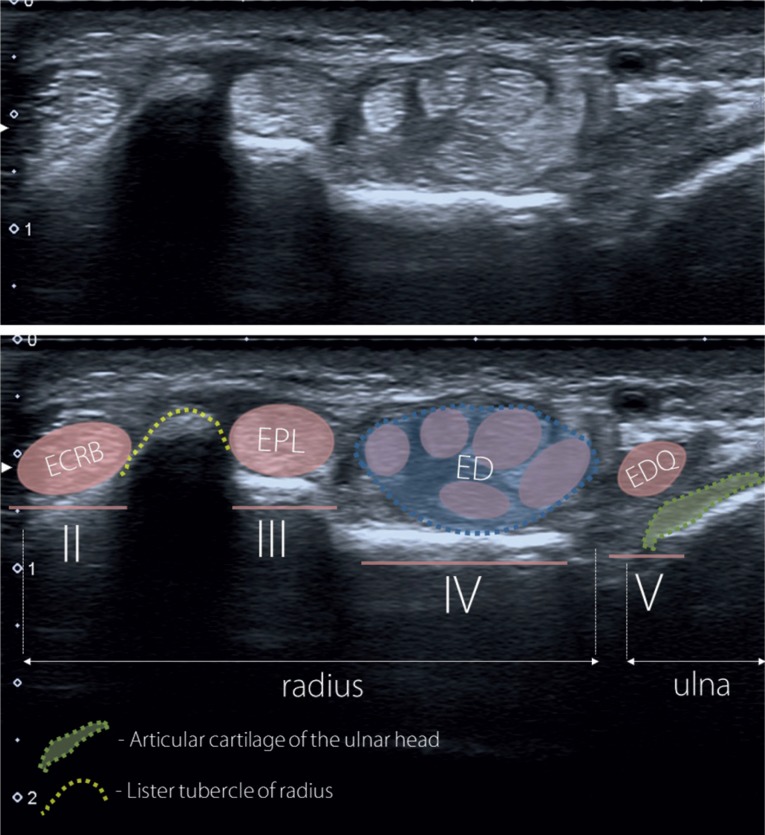 Fig. 12