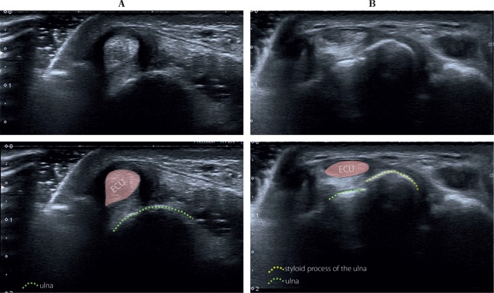 Fig. 14