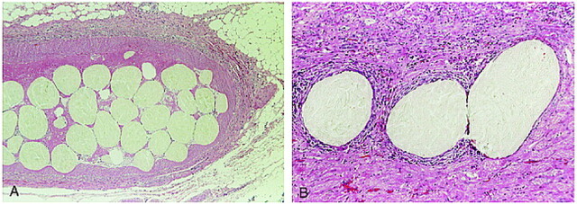 fig 3.