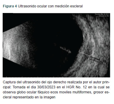 Figura 4