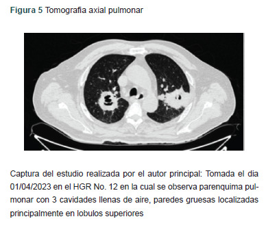 Figura 5