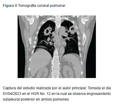 Figura 6
