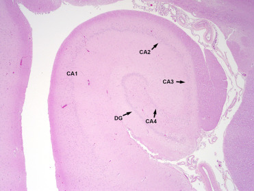 Figure 23.3