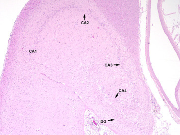 Figure 23.4